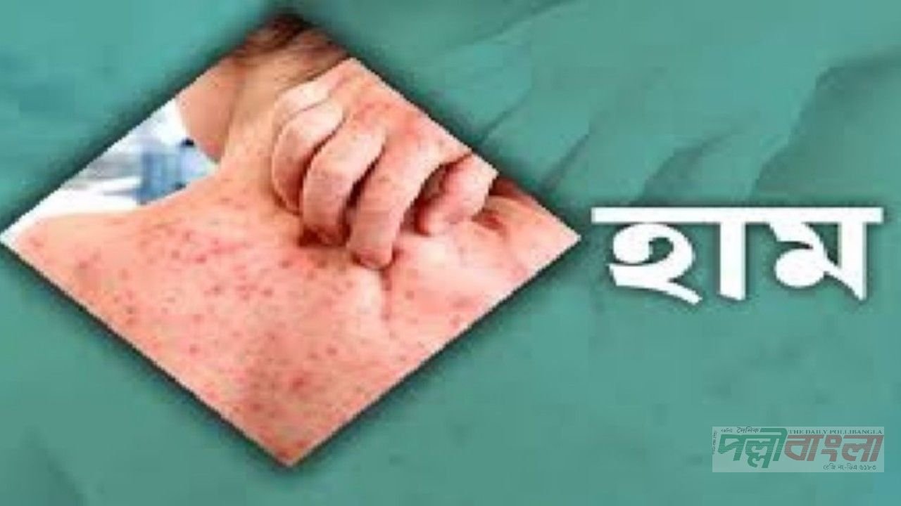 হামে আরও ৮ জনের মৃত্যু, নতুন আক্রান্ত ১০৬৫